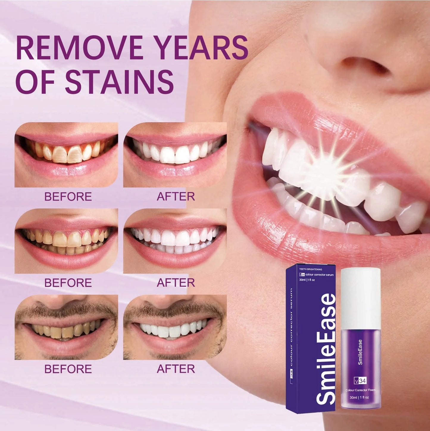 2 Pcs Teeth Whitening Serum (Guaranteed Result)