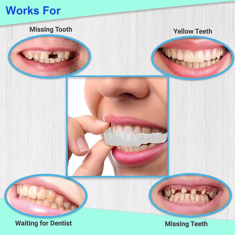 2 Pcs Tooth Cover (One Size Fits All)
